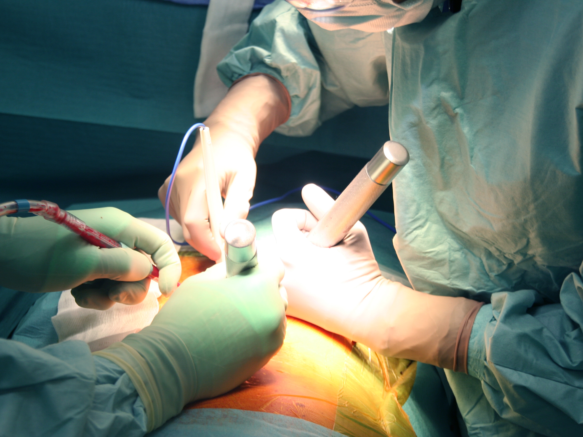 slider-chirurgie-bleu-opération